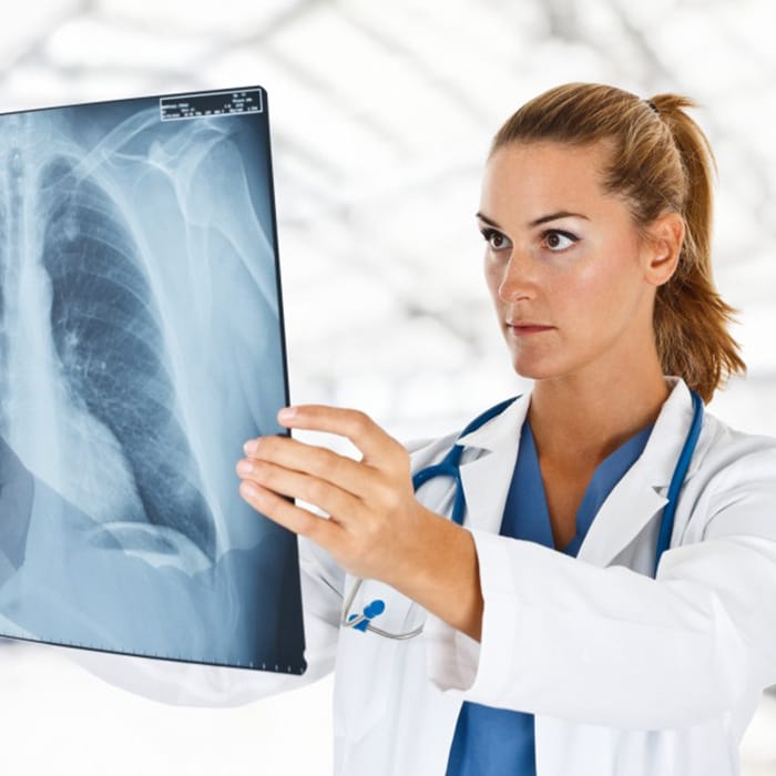 X-Ray